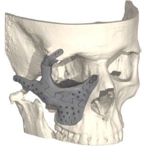 Webp.net-resizeimage PSI1