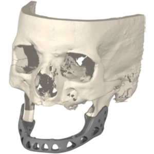 Webp.net-resizeimage PSI2