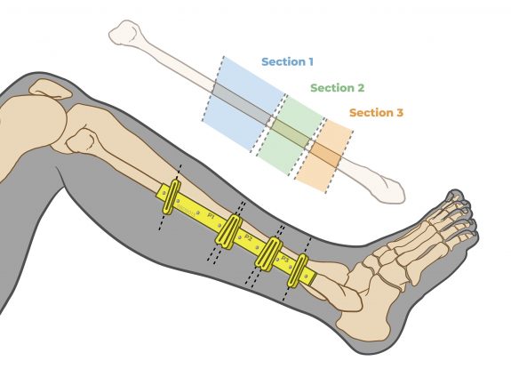 Hossein_SurgicalGuide_05